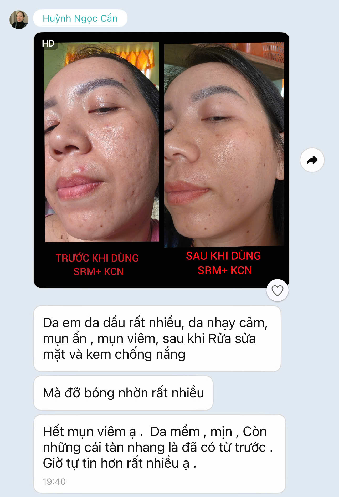 Phản hồi khách hàng về sữa rửa mặt Hoàng Sơn 1